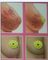 breast enlargement patch supplier